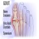 Gout