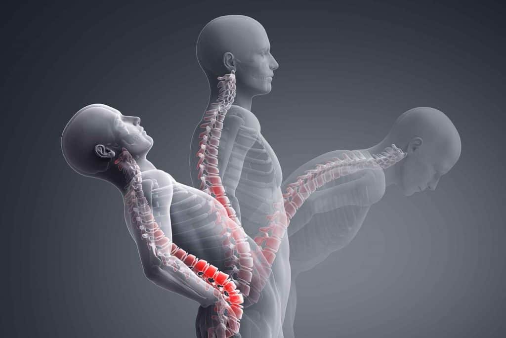 Joint Hypermobility