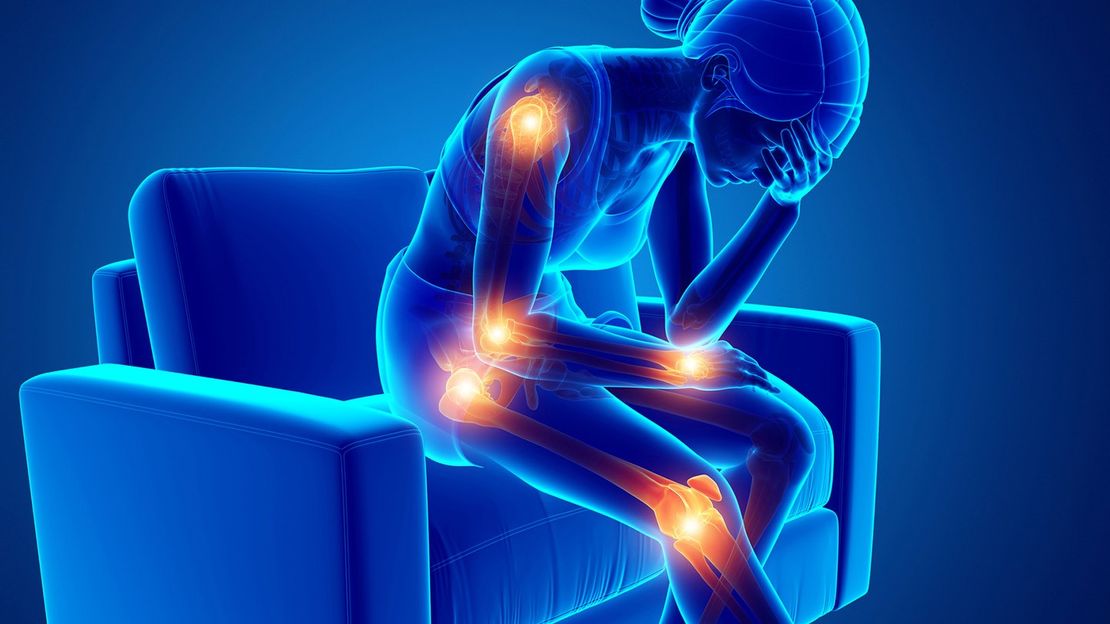 Psoriatic Arthritis